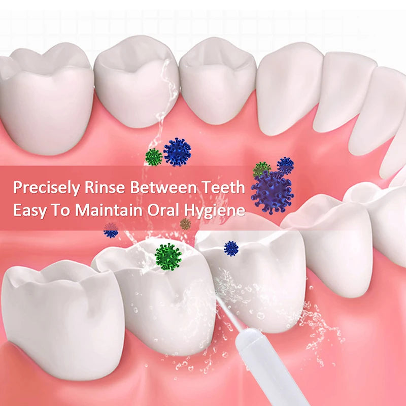 1PC High-Pressure Oral Irrigator Household Water Flosser Manual Oral Irrigator Portable Teeth Clean Water Flosser for Brace
